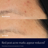 Estée Lauder Advanced Night Repair Rescue Solution Serum With 15% Bifidus Ferment - 0.7 oz.