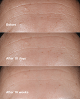 Clinique Smart Clinical Repair Wrinkle Correcting Serum - 1 oz.