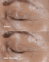 Clinique Smart Clinical Repair Wrinkle Correcting Eye Cream - 0.5 oz.