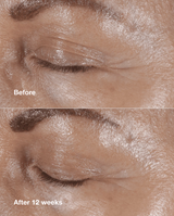 Clinique Smart Clinical Repair Wrinkle Correcting Eye Cream - 1 oz.