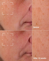 Clinique Even Better Clinical Dark Spot Clearing Serum - 1.0 oz.